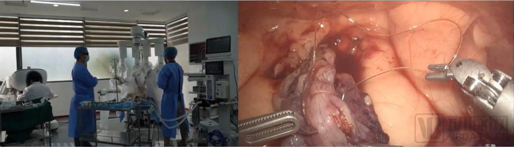 Agibot ™腔镜手术机器人成功开展全泌尿外科典型术式动物实验，敏捷医疗加速进入注册临床阶段