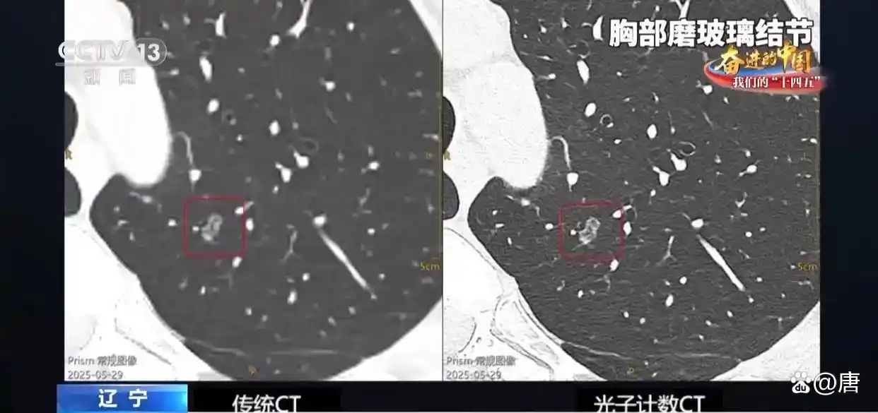 医疗展 破壁者强！国产医疗“黑科技”逆袭全球，手术刀下的中国制造惊艳世界